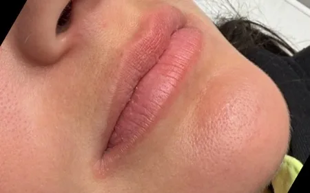 Labios de una clienta de MOSS antes